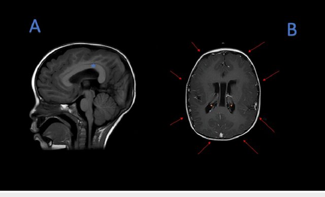 MRI T1 sequences