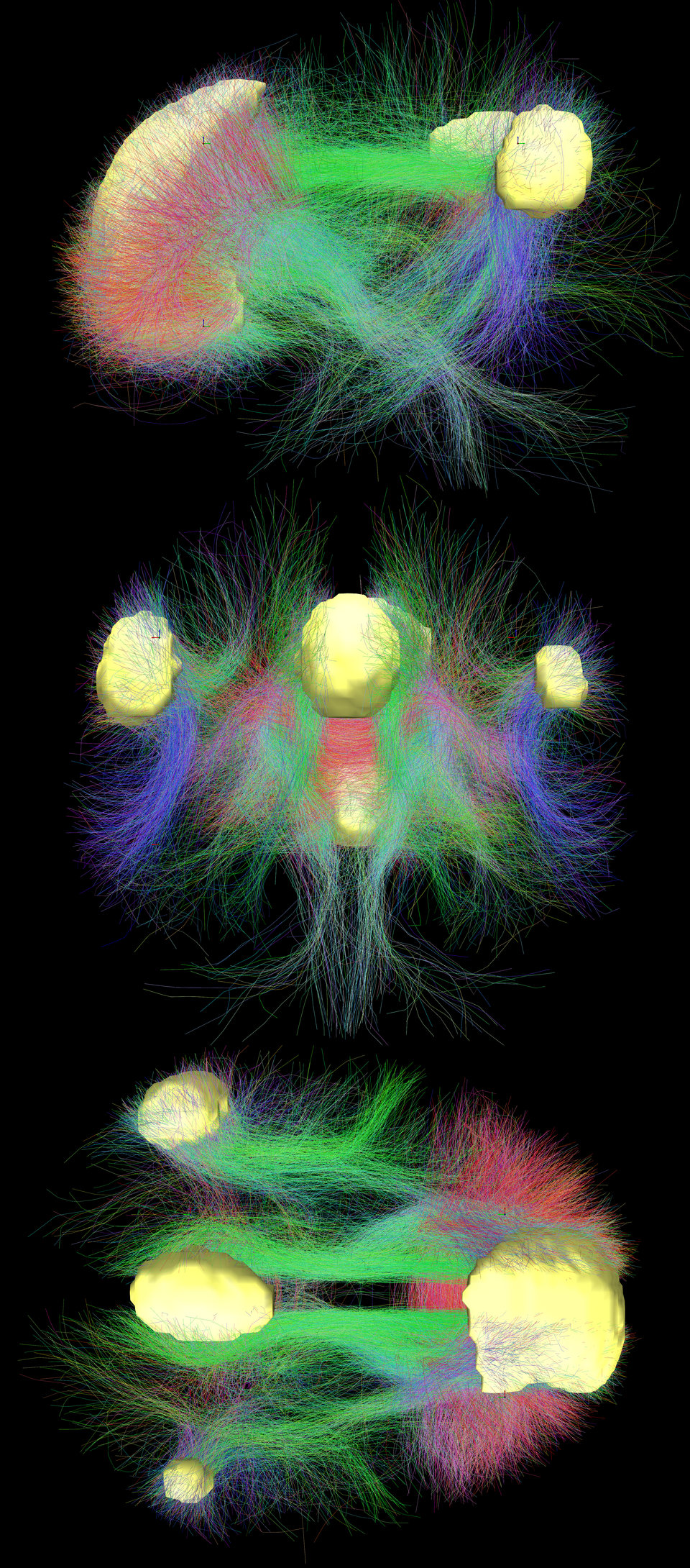 DMN connectivity