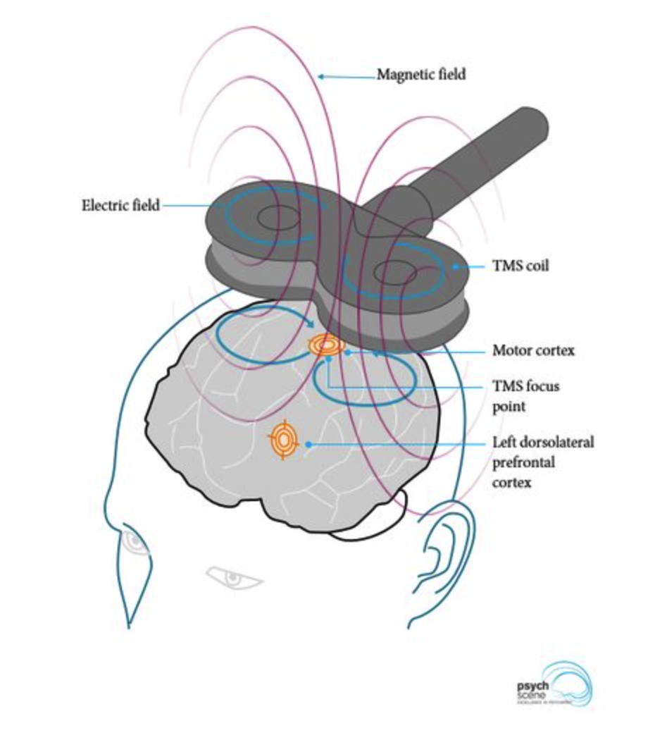 TMS schematic